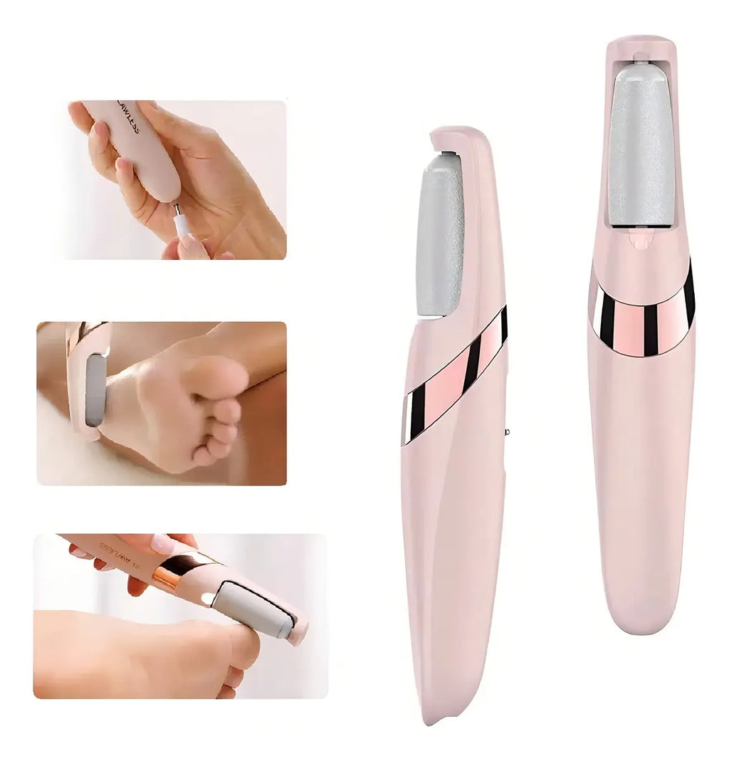 Removedor De Callos Electrico Usb Recargable Quitacallos